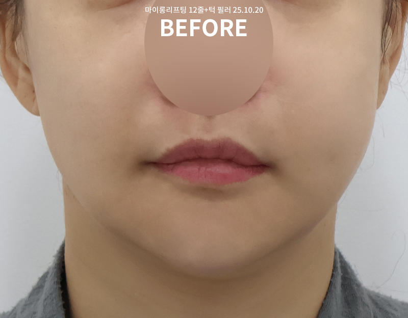 68c2f30079891823260fdd344c0f285a_1761643306_9199.png 68c2f30079891823260fdd344c0f285a_1761643306_9199.png