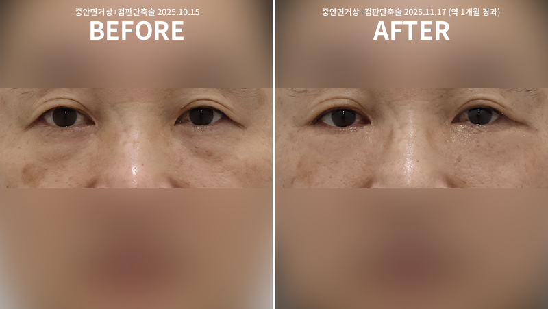 20baf4497954c3066d7cdef76bf37c53_1763519219_4438.png 20baf4497954c3066d7cdef76bf37c53_1763519219_4438.png