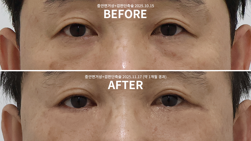 20baf4497954c3066d7cdef76bf37c53_1763519219_573.png 20baf4497954c3066d7cdef76bf37c53_1763519219_573.png