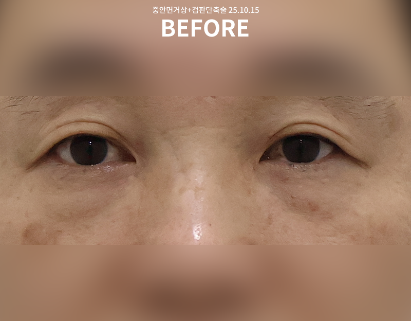 20baf4497954c3066d7cdef76bf37c53_1763519220_7353.png 20baf4497954c3066d7cdef76bf37c53_1763519220_7353.png