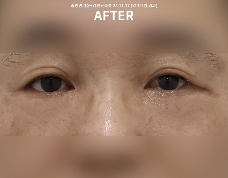 20baf4497954c3066d7cdef76bf37c53_1763519220_8112.png 20baf4497954c3066d7cdef76bf37c53_1763519220_8112.png