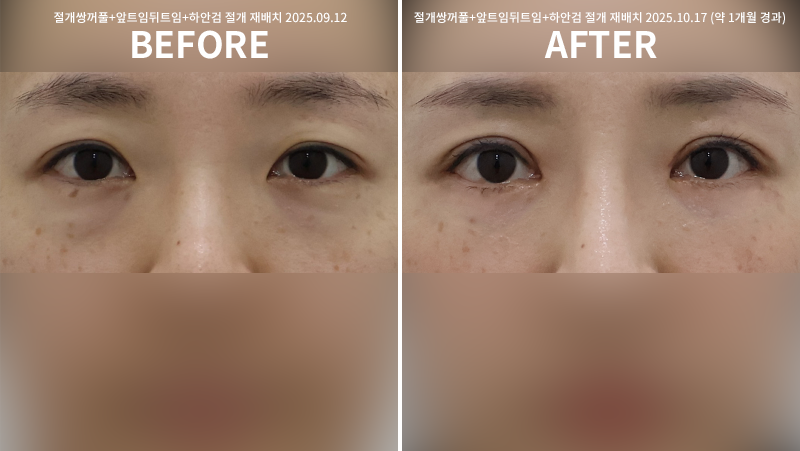 52a82a4d26541641314deaa27aab3c34_1762414084_7545.png 52a82a4d26541641314deaa27aab3c34_1762414084_7545.png