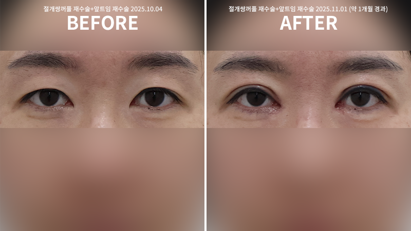 7fe6fe11da36214ca6b8ae9afd0ac6c2_1762146309_851.png 7fe6fe11da36214ca6b8ae9afd0ac6c2_1762146309_851.png