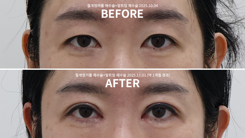 7fe6fe11da36214ca6b8ae9afd0ac6c2_1762146310_0218.png 7fe6fe11da36214ca6b8ae9afd0ac6c2_1762146310_0218.png