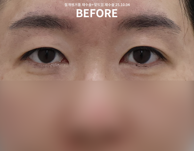 7fe6fe11da36214ca6b8ae9afd0ac6c2_1762146310_2517.png 7fe6fe11da36214ca6b8ae9afd0ac6c2_1762146310_2517.png