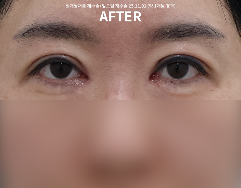 7fe6fe11da36214ca6b8ae9afd0ac6c2_1762146310_4348.png 7fe6fe11da36214ca6b8ae9afd0ac6c2_1762146310_4348.png