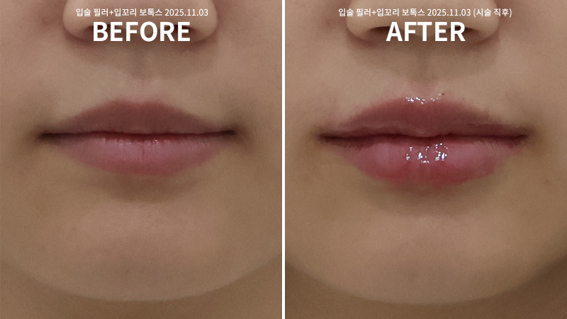 7fe6fe11da36214ca6b8ae9afd0ac6c2_1762158050_6002.png 7fe6fe11da36214ca6b8ae9afd0ac6c2_1762158050_6002.png