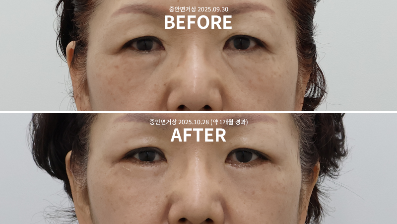 d92f773b1a9500c06b8a07df9861f10c_1762136944_3188.png d92f773b1a9500c06b8a07df9861f10c_1762136944_3188.png