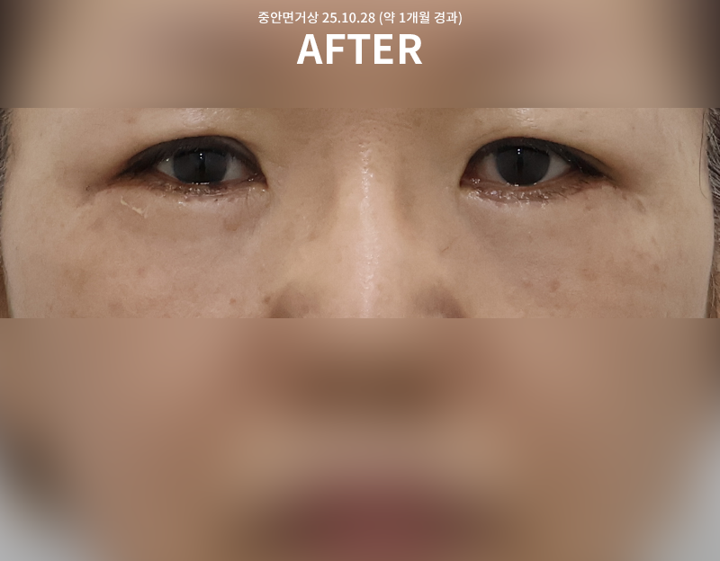 d92f773b1a9500c06b8a07df9861f10c_1762136944_5865.png d92f773b1a9500c06b8a07df9861f10c_1762136944_5865.png