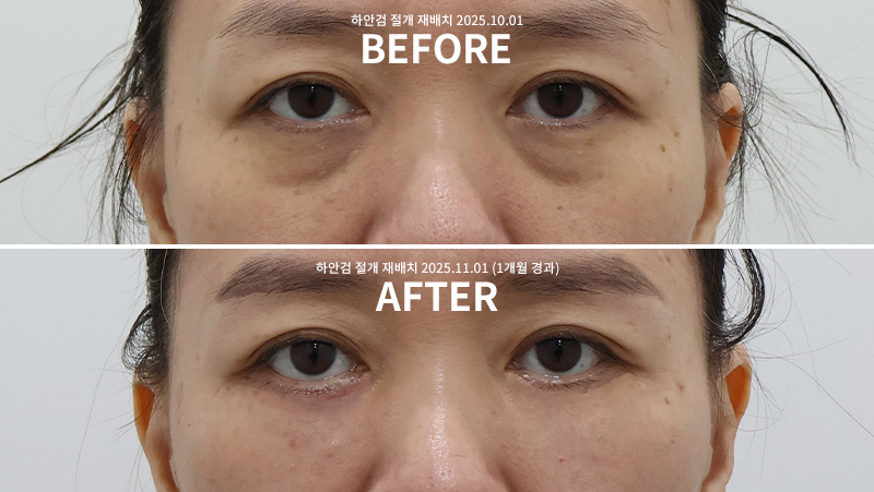 f22aac62e28b00711a7fcecafabada73_1762235955_6549.png f22aac62e28b00711a7fcecafabada73_1762235955_6549.png