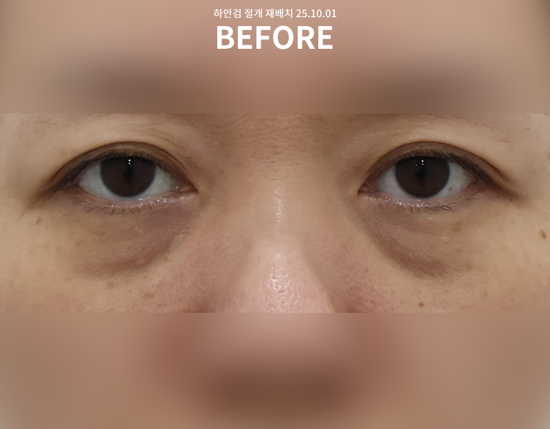 f22aac62e28b00711a7fcecafabada73_1762235955_793.png f22aac62e28b00711a7fcecafabada73_1762235955_793.png