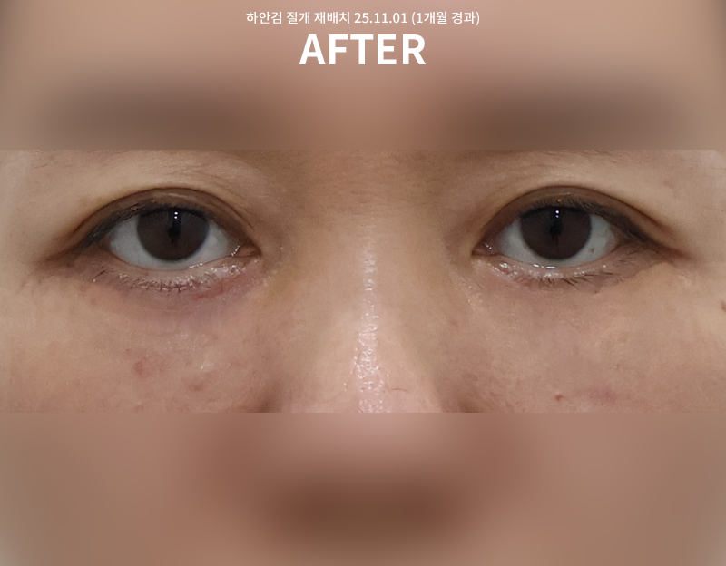 f22aac62e28b00711a7fcecafabada73_1762235955_9286.png f22aac62e28b00711a7fcecafabada73_1762235955_9286.png