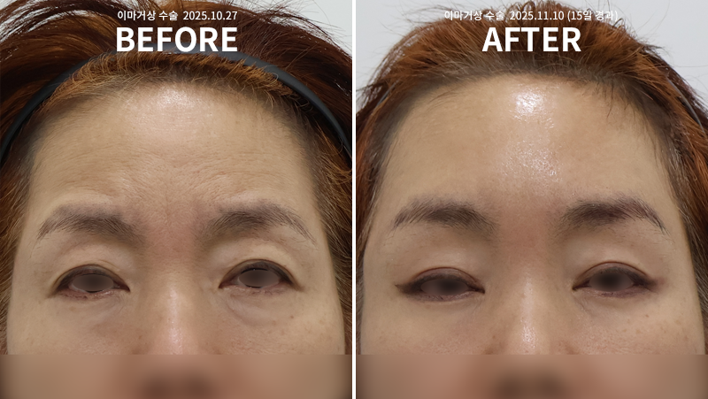 22594e426d94dccb4e3d0be2753847c2_1765422828_4435.png 22594e426d94dccb4e3d0be2753847c2_1765422828_4435.png