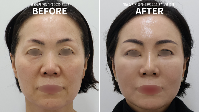 3459aff1a949605a0b2ceebee8aa7ee4_1765354968_8328.png 3459aff1a949605a0b2ceebee8aa7ee4_1765354968_8328.png