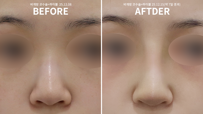 3f4dcfcdafab069a2538c3ff01b722f1_1765863599_7818.png 3f4dcfcdafab069a2538c3ff01b722f1_1765863599_7818.png