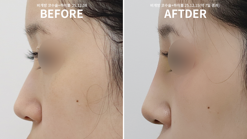 3f4dcfcdafab069a2538c3ff01b722f1_1765863599_8617.png 3f4dcfcdafab069a2538c3ff01b722f1_1765863599_8617.png