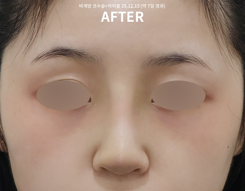 3f4dcfcdafab069a2538c3ff01b722f1_1765863616_8346.png 3f4dcfcdafab069a2538c3ff01b722f1_1765863616_8346.png