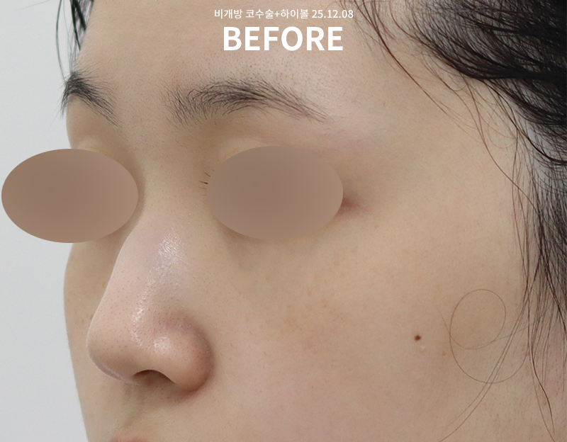 3f4dcfcdafab069a2538c3ff01b722f1_1765863630_394.png 3f4dcfcdafab069a2538c3ff01b722f1_1765863630_394.png