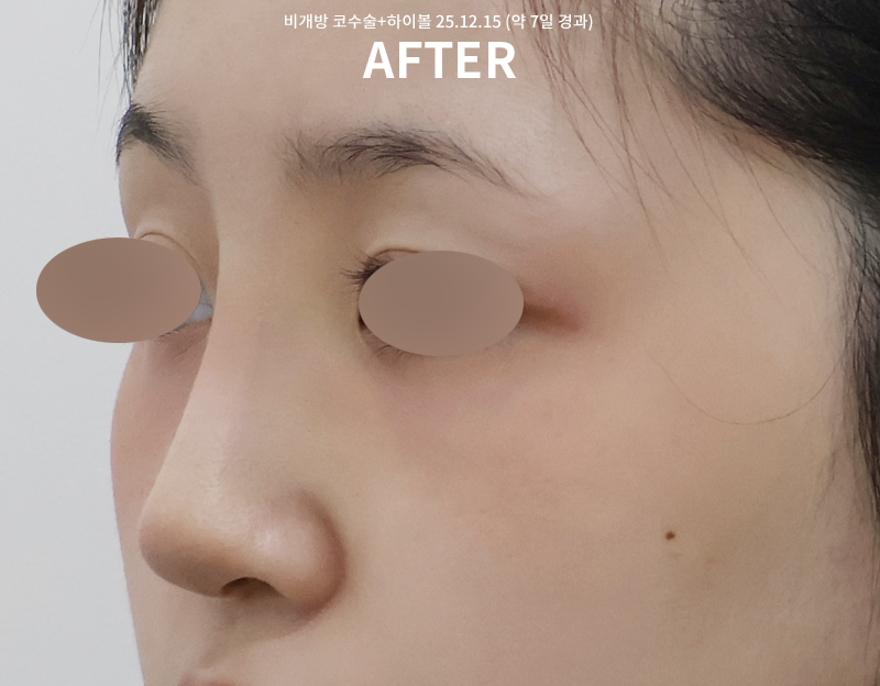 3f4dcfcdafab069a2538c3ff01b722f1_1765863630_4685.png 3f4dcfcdafab069a2538c3ff01b722f1_1765863630_4685.png