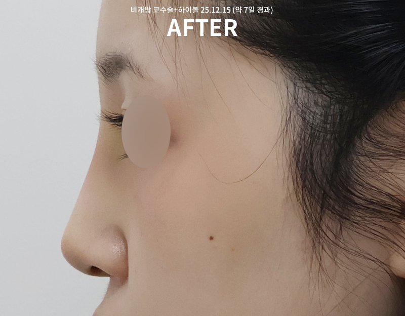 3f4dcfcdafab069a2538c3ff01b722f1_1765863640_4328.png 3f4dcfcdafab069a2538c3ff01b722f1_1765863640_4328.png