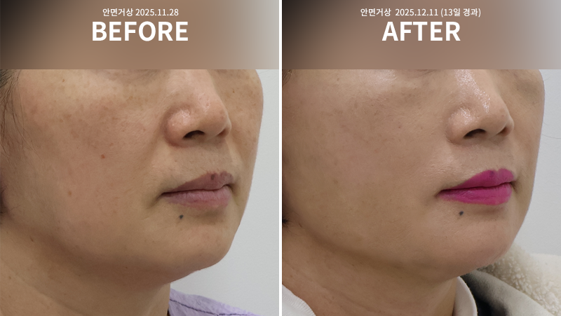 517c999c25bcee488685f499e12c1544_1765443299_8129.png 517c999c25bcee488685f499e12c1544_1765443299_8129.png