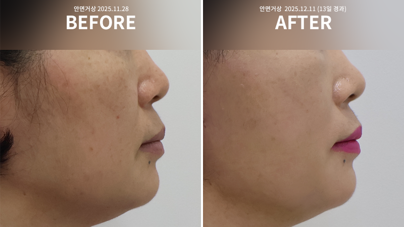 517c999c25bcee488685f499e12c1544_1765443299_8837.png 517c999c25bcee488685f499e12c1544_1765443299_8837.png