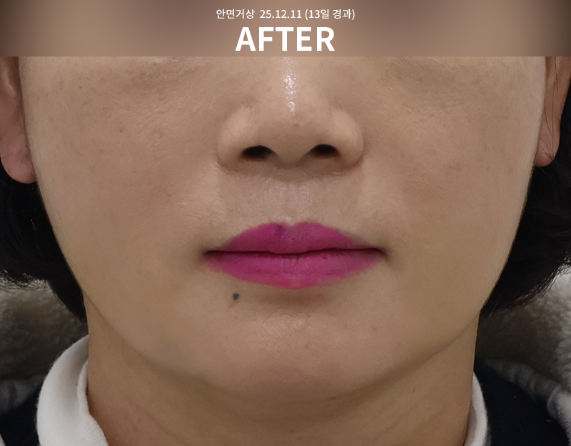 517c999c25bcee488685f499e12c1544_1765443300_0416.png 517c999c25bcee488685f499e12c1544_1765443300_0416.png