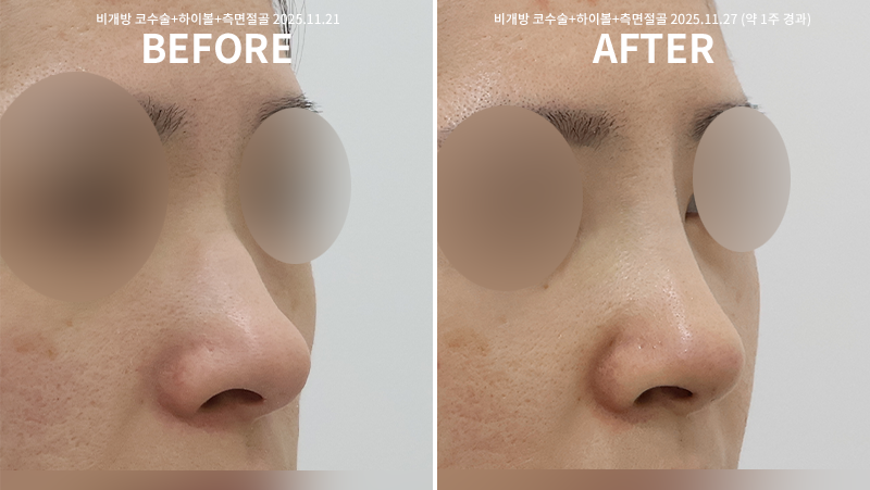 64353f33639461572aea72931808f771_1764826489_6996.png 64353f33639461572aea72931808f771_1764826489_6996.png