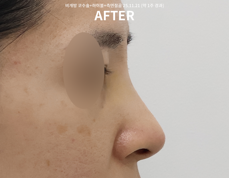 64353f33639461572aea72931808f771_1764826548_3766.png 64353f33639461572aea72931808f771_1764826548_3766.png