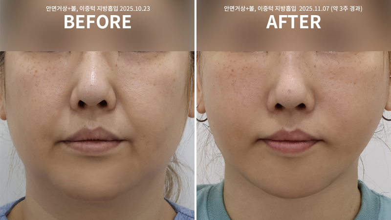 7962ed0a7407a07f73d84a2f2be356bf_1764748503_0661.png 7962ed0a7407a07f73d84a2f2be356bf_1764748503_0661.png