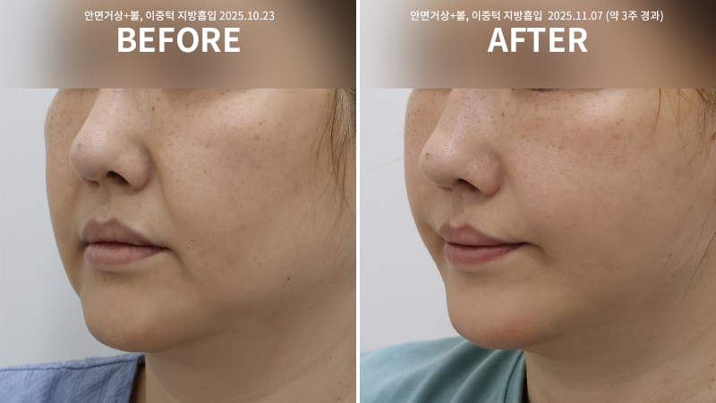 7962ed0a7407a07f73d84a2f2be356bf_1764748503_1949.png 7962ed0a7407a07f73d84a2f2be356bf_1764748503_1949.png