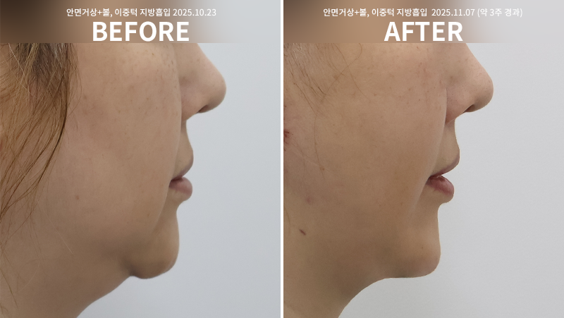 7962ed0a7407a07f73d84a2f2be356bf_1764748503_2786.png 7962ed0a7407a07f73d84a2f2be356bf_1764748503_2786.png