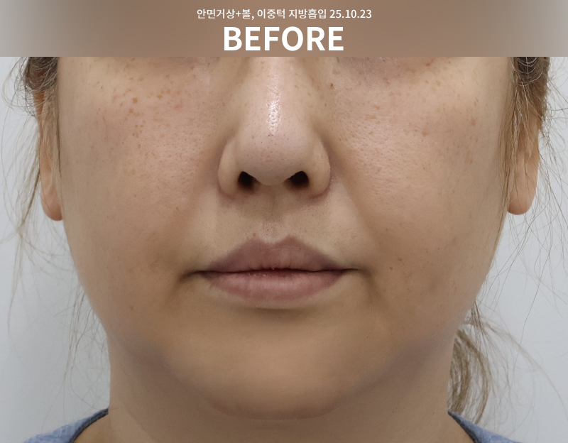 7962ed0a7407a07f73d84a2f2be356bf_1764748503_3723.png 7962ed0a7407a07f73d84a2f2be356bf_1764748503_3723.png