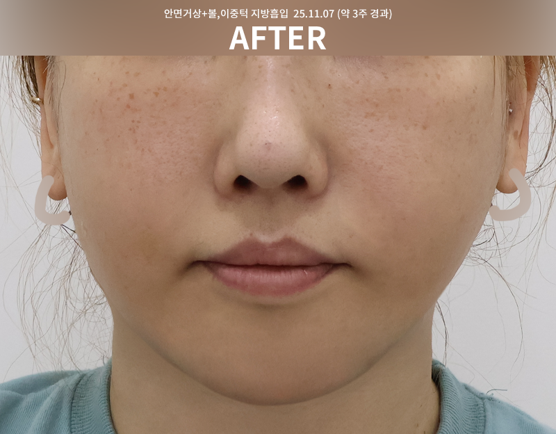 7962ed0a7407a07f73d84a2f2be356bf_1764748503_4613.png 7962ed0a7407a07f73d84a2f2be356bf_1764748503_4613.png