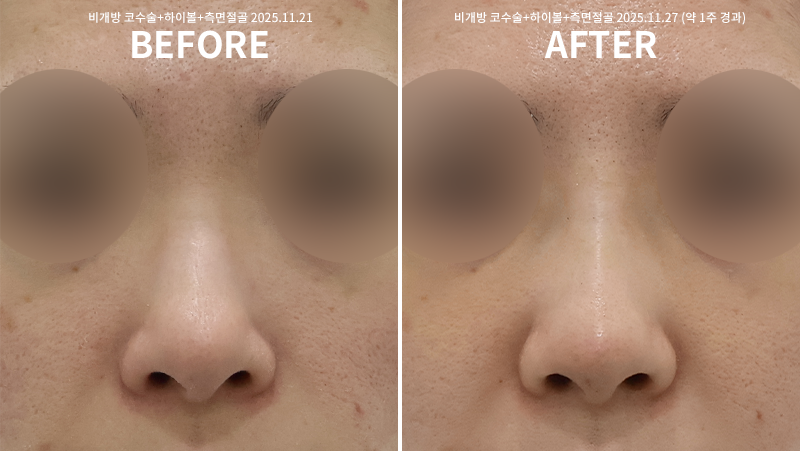 7962ed0a7407a07f73d84a2f2be356bf_1764748750_0383.png 7962ed0a7407a07f73d84a2f2be356bf_1764748750_0383.png