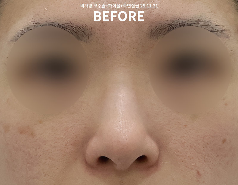 7962ed0a7407a07f73d84a2f2be356bf_1764748750_311.png 7962ed0a7407a07f73d84a2f2be356bf_1764748750_311.png