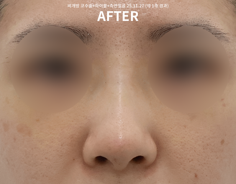 7962ed0a7407a07f73d84a2f2be356bf_1764748750_3942.png 7962ed0a7407a07f73d84a2f2be356bf_1764748750_3942.png