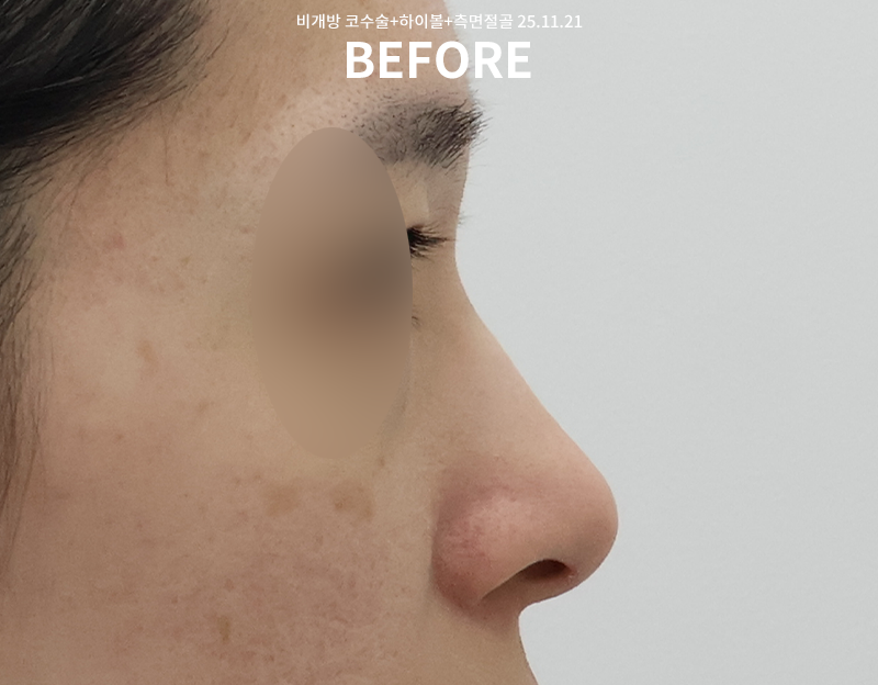 7962ed0a7407a07f73d84a2f2be356bf_1764748750_6401.png 7962ed0a7407a07f73d84a2f2be356bf_1764748750_6401.png