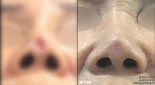 9409a46794d3b690b2c19b2400c1f9df_1764931831_2855.jpg 9409a46794d3b690b2c19b2400c1f9df_1764931831_2855.jpg