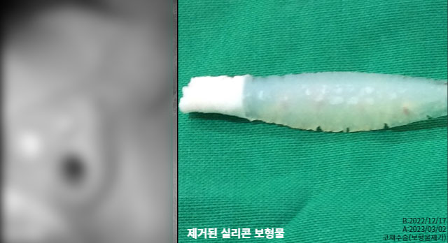 9409a46794d3b690b2c19b2400c1f9df_1764931852_0788.jpg 9409a46794d3b690b2c19b2400c1f9df_1764931852_0788.jpg