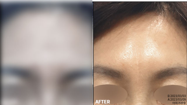 9409a46794d3b690b2c19b2400c1f9df_1764932089_8847.jpg 9409a46794d3b690b2c19b2400c1f9df_1764932089_8847.jpg