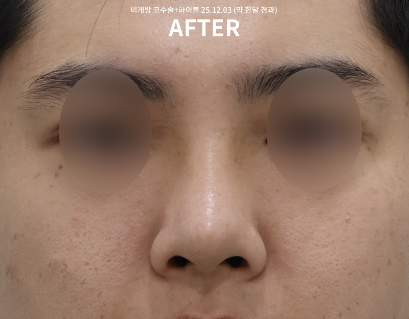 9bf04bbf0cb2ddd11ae11fdfe05a789d_1765249389_6401.png 9bf04bbf0cb2ddd11ae11fdfe05a789d_1765249389_6401.png