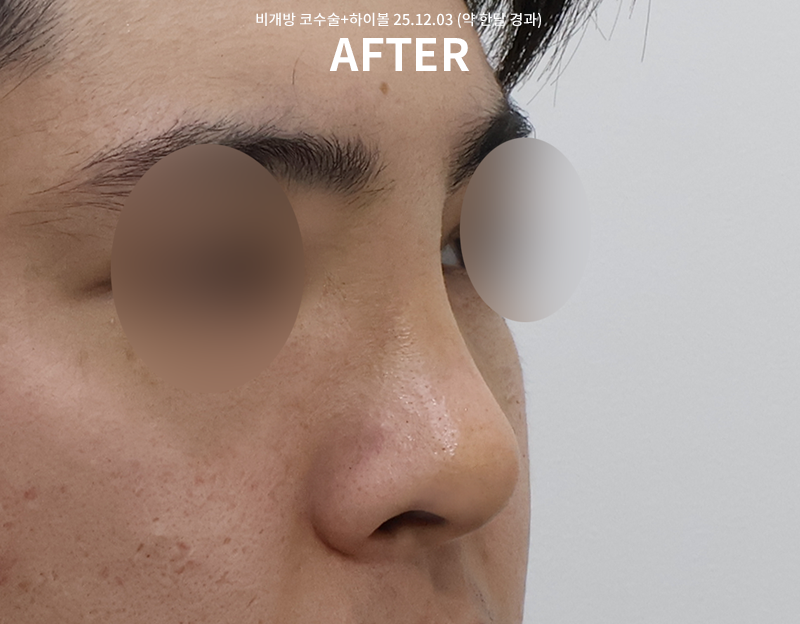 9bf04bbf0cb2ddd11ae11fdfe05a789d_1765249389_7721.png 9bf04bbf0cb2ddd11ae11fdfe05a789d_1765249389_7721.png