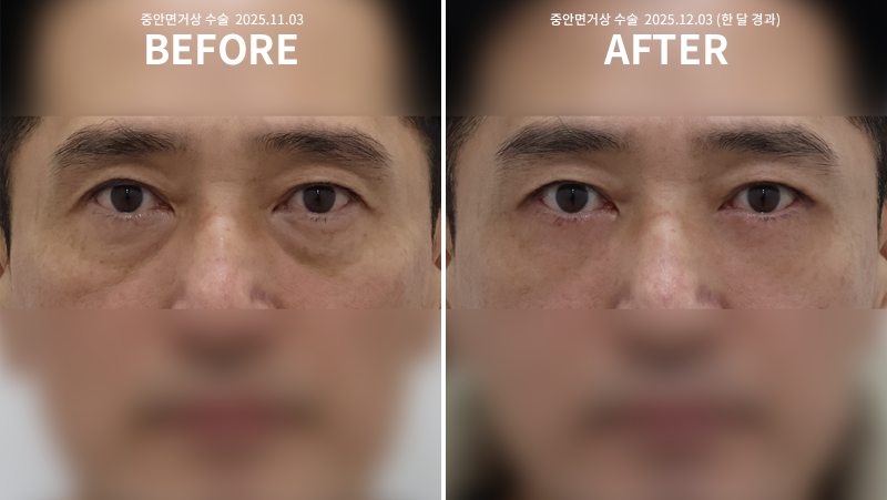 9bf04bbf0cb2ddd11ae11fdfe05a789d_1765249853_6643.png 9bf04bbf0cb2ddd11ae11fdfe05a789d_1765249853_6643.png