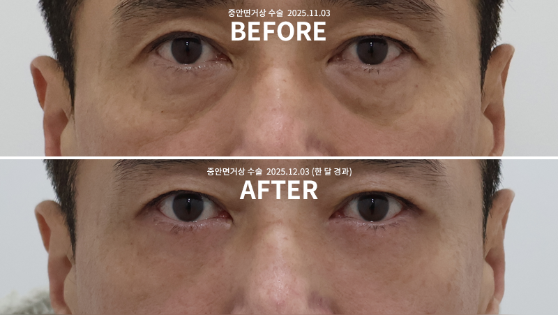 9bf04bbf0cb2ddd11ae11fdfe05a789d_1765249901_8079.png 9bf04bbf0cb2ddd11ae11fdfe05a789d_1765249901_8079.png