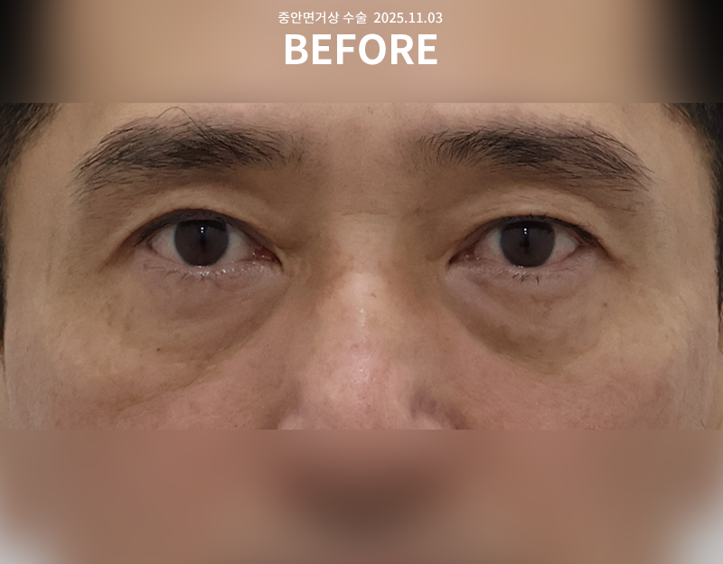 9bf04bbf0cb2ddd11ae11fdfe05a789d_1765249901_867.png 9bf04bbf0cb2ddd11ae11fdfe05a789d_1765249901_867.png