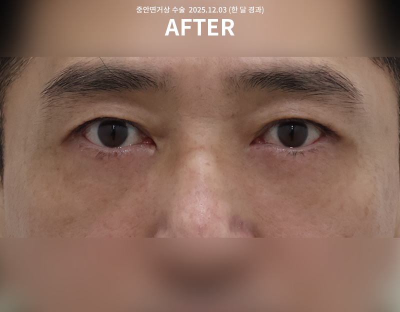 9bf04bbf0cb2ddd11ae11fdfe05a789d_1765249901_9181.png 9bf04bbf0cb2ddd11ae11fdfe05a789d_1765249901_9181.png