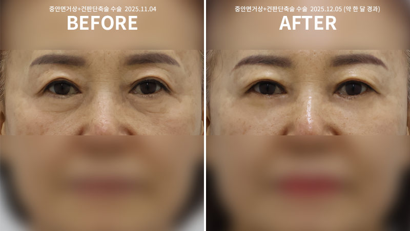 9bf04bbf0cb2ddd11ae11fdfe05a789d_1765250111_4191.png 9bf04bbf0cb2ddd11ae11fdfe05a789d_1765250111_4191.png