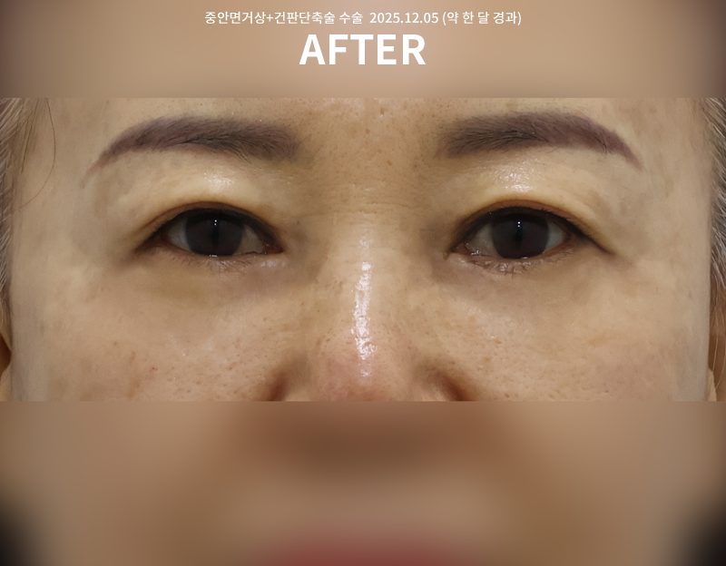 9bf04bbf0cb2ddd11ae11fdfe05a789d_1765250132_8742.png 9bf04bbf0cb2ddd11ae11fdfe05a789d_1765250132_8742.png