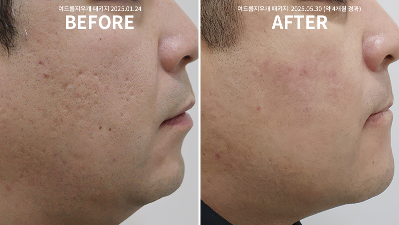 ab1d27bb0c92f1d1a816079283e806d1_1765178268_3391.png ab1d27bb0c92f1d1a816079283e806d1_1765178268_3391.png